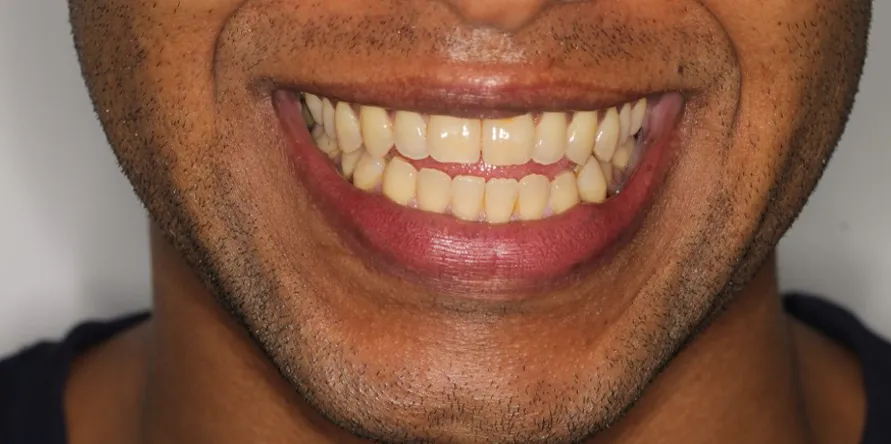 ortodoncia-2