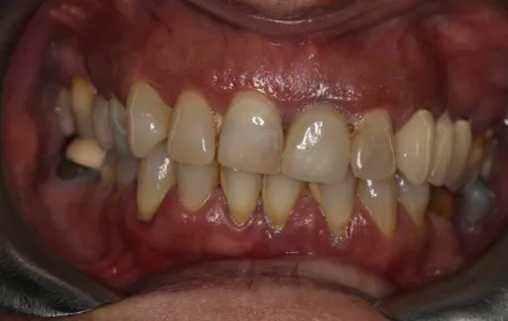 casos456 antes 01
