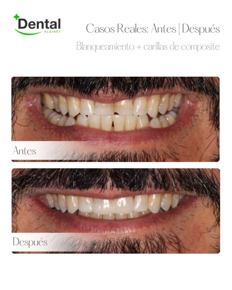 Instagram post from alginetmasdental. This post is in position 19.