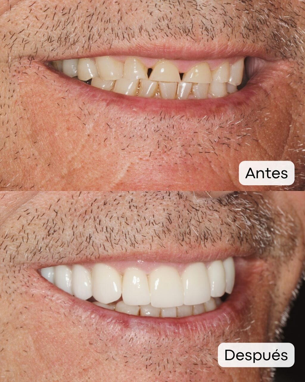 Instagram post from alginetmasdental. This post is in position 1.