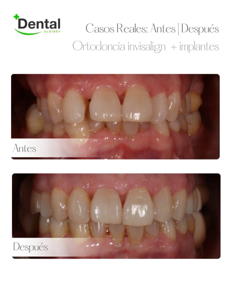 Instagram post from alginetmasdental. This post is in position 13.