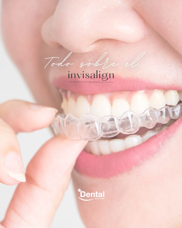 Instagram post from alginetmasdental. This post is in position 18.