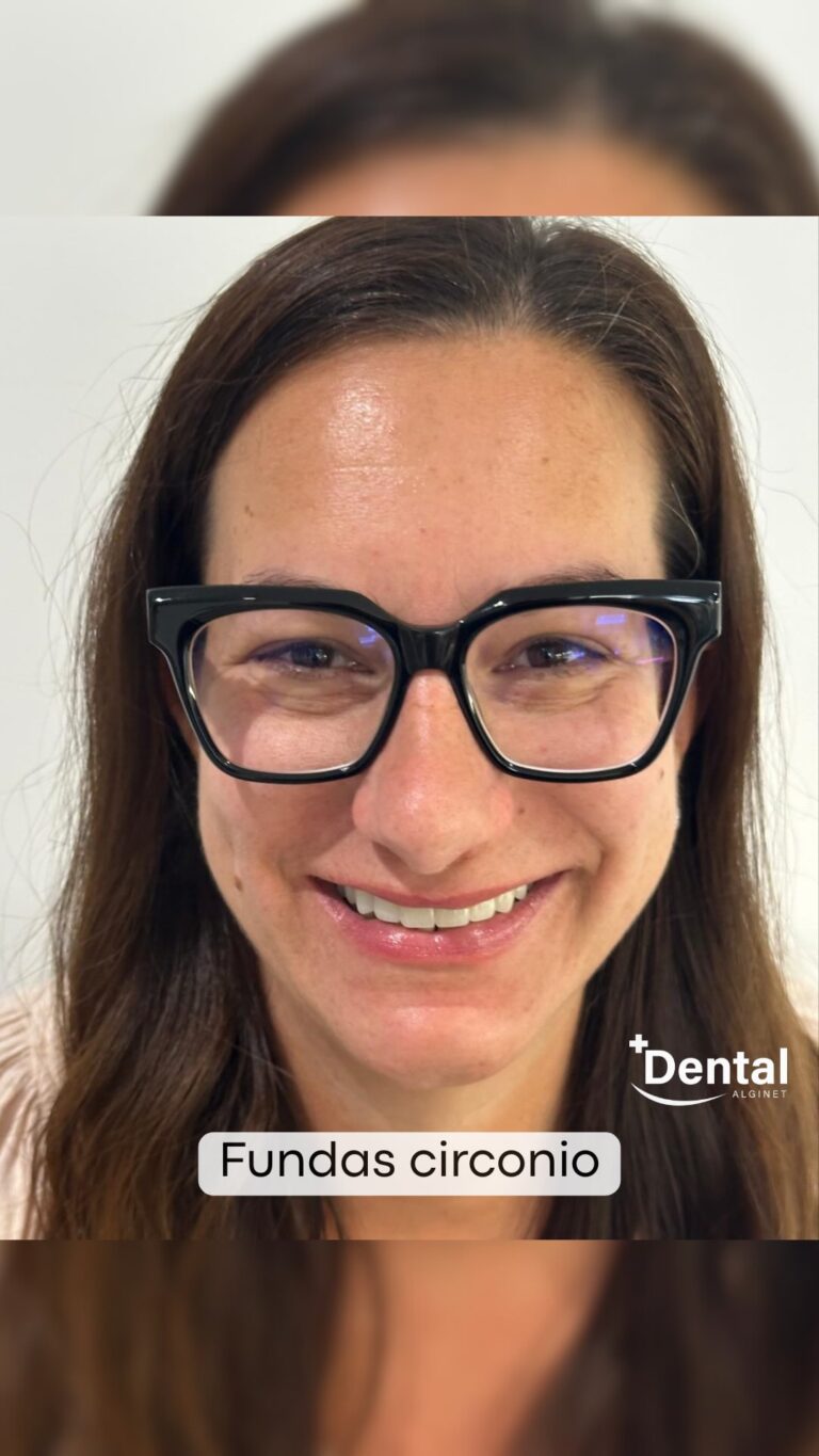 Instagram post from alginetmasdental. This post is in position 3.
