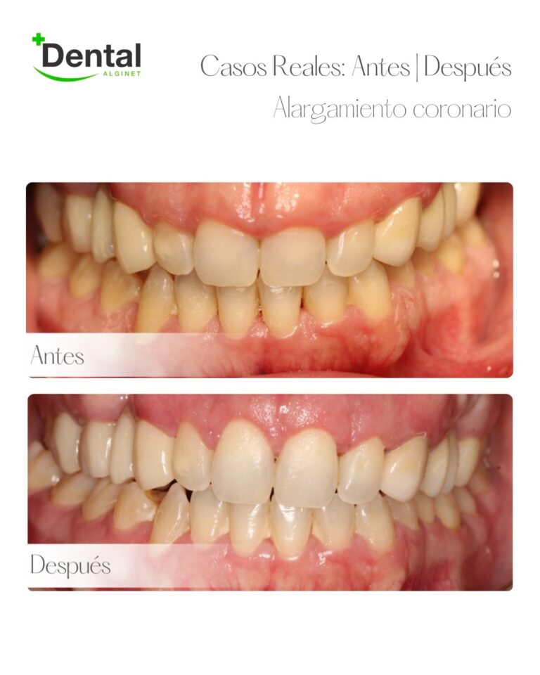 Instagram post from alginetmasdental. This post is in position 15.