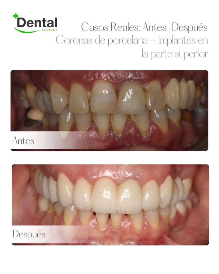 Instagram post from alginetmasdental. This post is in position 11.