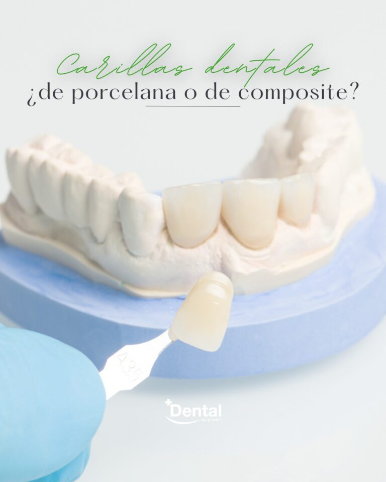 Instagram post from alginetmasdental. This post is in position 16.