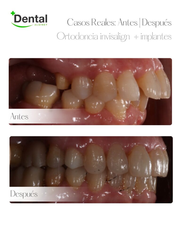 Instagram post from alginetmasdental. This post is in position 7.