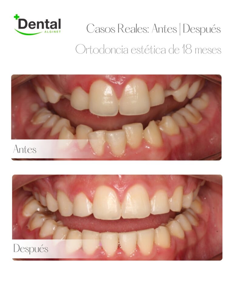 Instagram post from alginetmasdental. This post is in position 9.