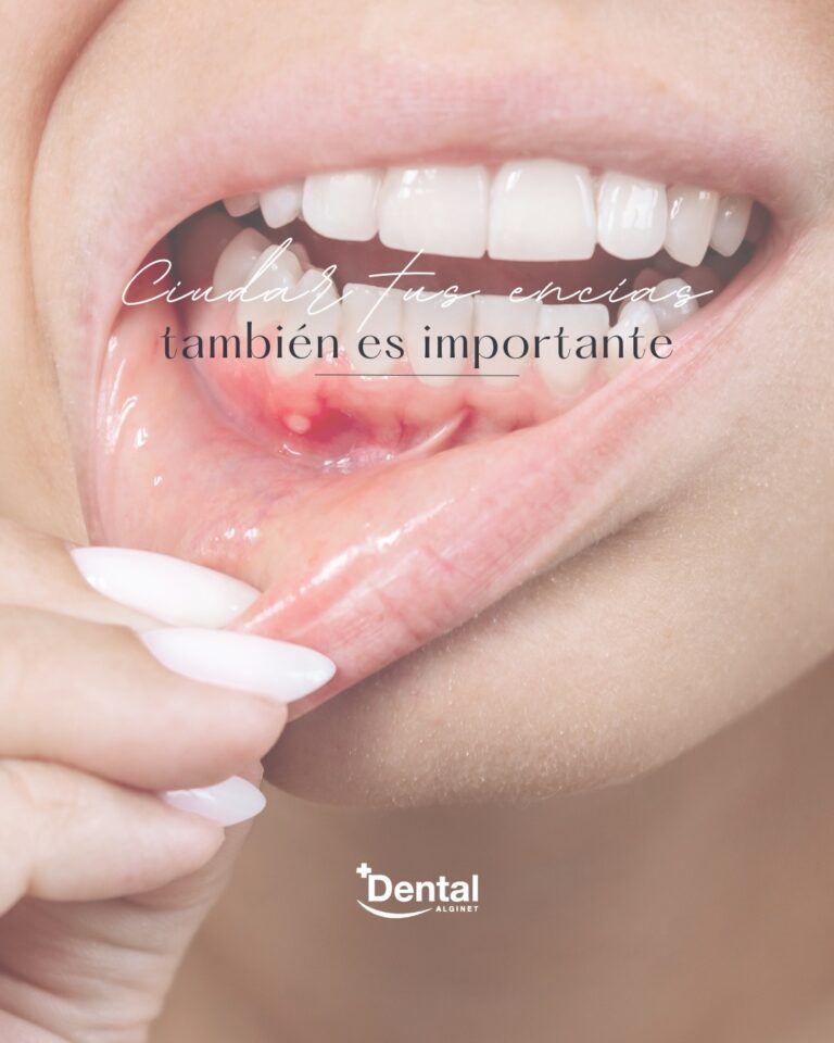 Instagram post from alginetmasdental. This post is in position 20.