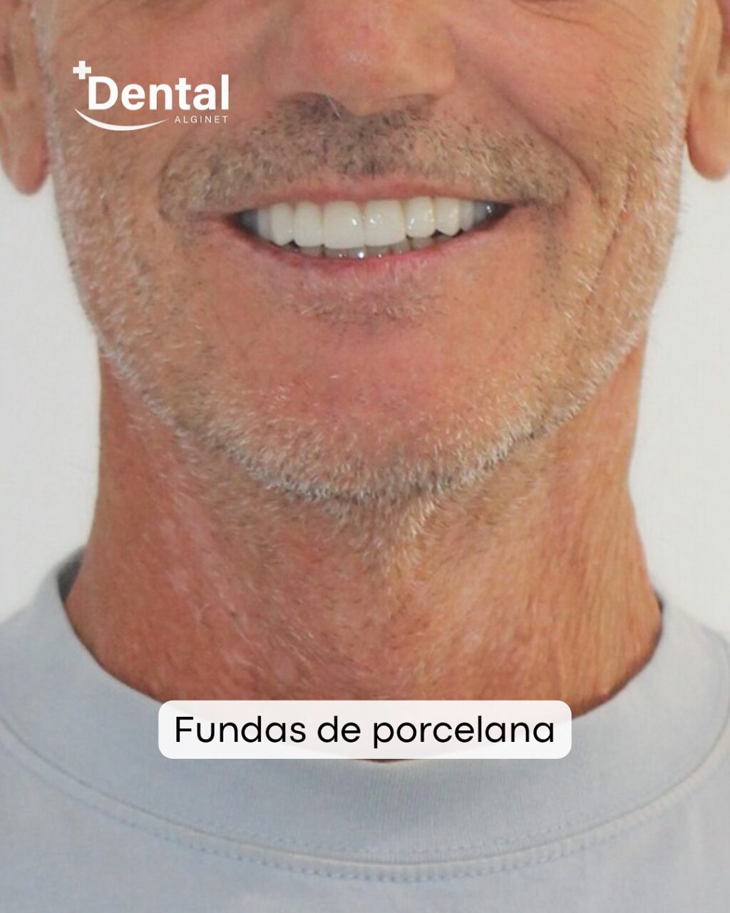 Instagram post from alginetmasdental. This post is in position 0.