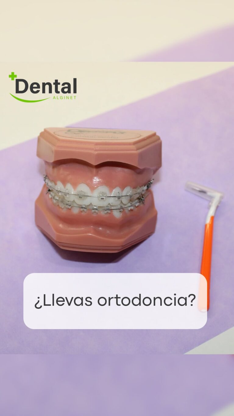 Instagram post from alginetmasdental. This post is in position 2.