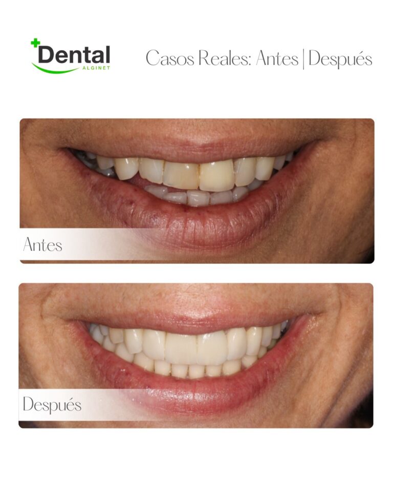 Instagram post from alginetmasdental. This post is in position 17.