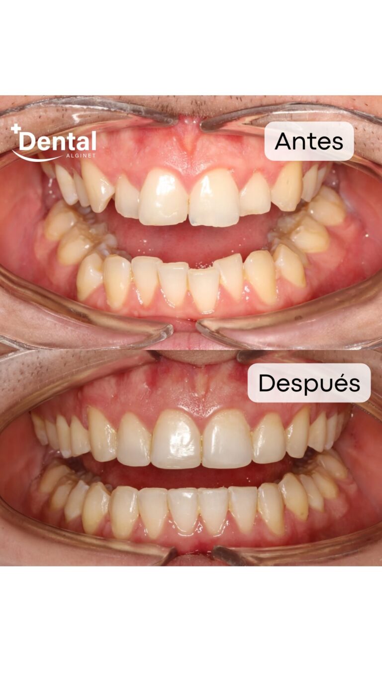 Instagram post from alginetmasdental. This post is in position 4.